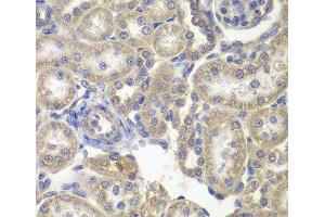 Immunohistochemistry of paraffin-embedded Rat kidney using H6PD Polyclonal Antibody at dilution of 1:200 (40x lens). (Glucose-6-Phosphate Dehydrogenase antibody)