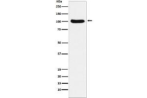 Western blot analysis of Cellular Apoptosis Susceptibility expression in Ramos cell lysate. (Recombinant Exportin 2 antibody)