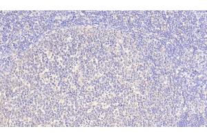 Detection of SRGN in Human Lymph node Tissue using Polyclonal Antibody to Serglycin (SRGN) (SRGN antibody  (AA 28-158))