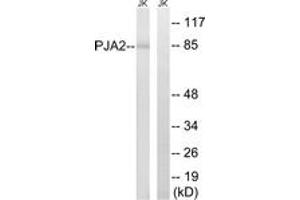 Western blot analysis of extracts from Jurkat cells, using PJA2 Antibody. (PJA2 antibody  (AA 141-190))