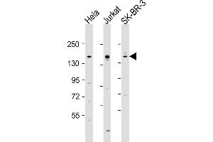 All lanes : Anti-FANCD2 Antibody (Center) at 1:2000 dilution Lane 1: Hela whole cell lysates Lane 2: Jurkat whole cell lysates Lane 3: SK-BR-3 whole cell lysates Lysates/proteins at 20 μg per lane. (FANCD2 antibody  (AA 893-927))