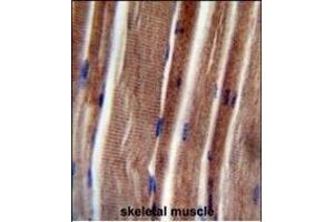 THUM3 Antibody (Center) (ABIN654774 and ABIN2844455) immunohistochemistry analysis in formalin fixed and paraffin embedded human skeletal muscle followed by peroxidase conjugation of the secondary antibody and DAB staining. (THUMPD3 antibody  (AA 194-223))