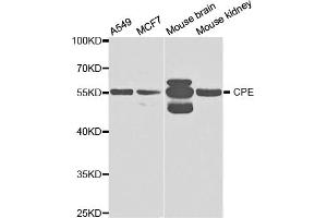 Western blot analysis of extracts of various cell lines, using CPE antibody (ABIN5973172) at 1/1000 dilution.