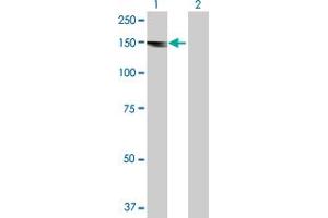 Western Blot analysis of ALS2 expression in transfected 293T cell line by ALS2 MaxPab polyclonal antibody. (ALS2 antibody  (AA 1-1237))