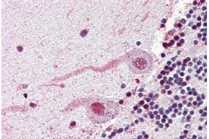 Brain, cerebellum, Human: Formalin-Fixed, Paraffin-Embedded (FFPE) (NEK7 antibody  (N-Term))