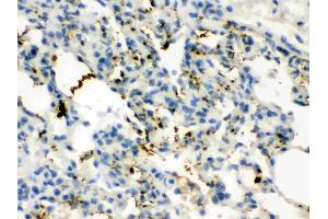 Calcitonin was detected in paraffin-embedded sections of rat lung tissues using rabbit anti- Calcitonin Antigen Affinity purified polyclonal antibody (Catalog # ) at 1 ? (CGRP antibody  (C-Term))
