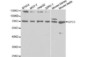 Western Blotting (WB) image for anti-Glypican 3 (GPC3) antibody (ABIN1875422)
