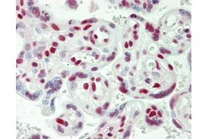 Human Placenta: Formalin-Fixed, Paraffin-Embedded (FFPE) (USP7 antibody  (AA 1-50))