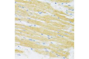 Immunohistochemistry of paraffin-embedded rat heart using TYROBP antibody (ABIN1876573) at dilution of 1:100 (40x lens).