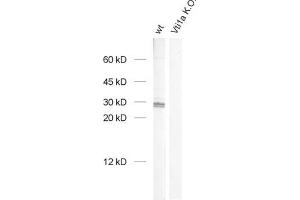 dilution: 1 : 1000, sample: brain homogenate from wildtype and Vti1a K. (VTI1A antibody  (AA 2-185))
