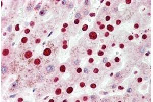 Human, Liver: Formalin-Fixed Paraffin-Embedded (FFPE) (NR2F6 antibody  (N-Term))