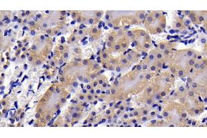 Detection of CASP3 in Mouse Kidney Tissue using Polyclonal Antibody to Caspase 3 (CASP3) (Caspase 3 antibody  (AA 29-175))