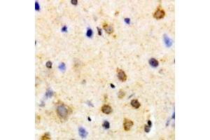 Immunohistochemical analysis of PSKH1 staining in human brain formalin fixed paraffin embedded tissue section. (PSKH1 antibody)