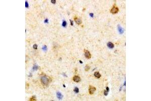 Immunohistochemical analysis of PSKH1 staining in human brain formalin fixed paraffin embedded tissue section. (PSKH1 antibody)