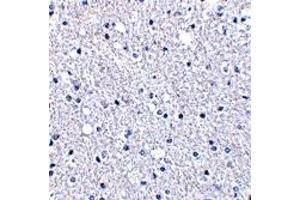 Immunohistochemistry (IHC) image for anti-TP53 induced glycolysis regulatory phosphatase (TIGAR) (Middle Region 1) antibody (ABIN1031193) (TIGAR antibody  (Middle Region 1))