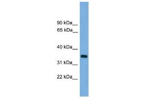 WB Suggested Anti-PRSS3 Antibody Titration: 0. (PRSS3 antibody  (N-Term))