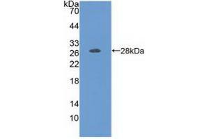 Western blot analysis of recombinant Human FOLR1. (FOLR1 antibody  (AA 25-234))