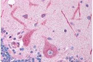 Human Brain, Cerebellum (formalin-fixed, paraffin-embedded) stained with FOXE3 antibody ABIN214754 at 5 ug/ml followed by biotinylated goat anti-rabbit IgG secondary antibody ABIN481713, alkaline phosphatase-streptavidin and chromogen. (FOXE3 antibody  (AA 235-284))