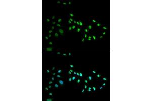 Immunofluorescence analysis of A549 cell using DNMT3A antibody. (DNMT3A antibody)