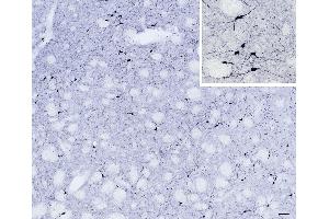 (ABIN184662) (scale bar: 50 μm, inset: 20 μm) immunostaining of NOS1 neurons in cryosection of a perfusion-fixed (4 % PFA) mouse caudate-putamen. (NOS1 antibody  (C-Term))