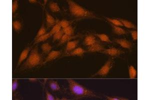 Immunofluorescence analysis of C6 cells using NRBF2 Polyclonal Antibody at dilution of 1:100. (NRBF2 antibody)