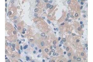Immunohistochemistry (IHC) image for anti-Mitogen-Activated Protein Kinase 3 (MAPK3) (AA 75-312) antibody (ABIN7433528)