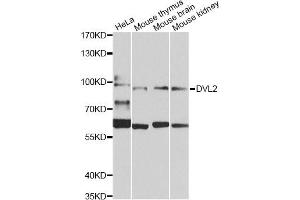Western blot analysis of extracts of various cell lines, using DVL2 Antibody (ABIN5975825) at 1/1000 dilution. (DVL2 antibody)