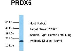Host: Rabbit Target Name: PRDX5 Sample Tissue: Human Fetal Lung Antibody Dilution: 1. (Peroxiredoxin 5 antibody  (Middle Region))