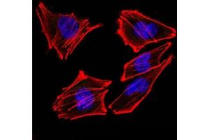 Confocal Immunofluorescent analysis of A2058 cells using AF488-labeled Isotype Control Monoclonal Antibody (IgG2a) (Green).