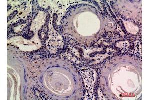 Immunohistochemistry (IHC) analysis of paraffin-embedded Human Skin, antibody was diluted at 1:200. (MOB3A/B antibody)