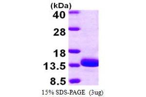 SDS-PAGE (SDS) image for Thiosulfate Sulfurtransferase (Rhodanese)-Like Domain Containing 1 (TSTD1) (AA 1-115) protein (His tag) (ABIN667378)