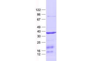 Western Blotting (WB) image for CAMP Responsive Element Modulator (CREM) protein (His tag) (ABIN2712557)
