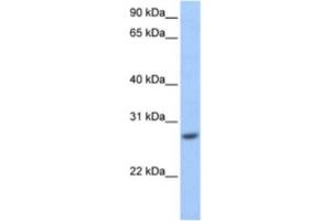 Western Blotting (WB) image for anti-Glutathione S-Transferase mu 3 (Brain) (GSTM3) antibody (ABIN2463566) (GSTM3 antibody)