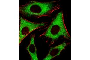 Fluorescent image of Hela cells stained with RPLP0P6 Antibody (N-term) (ABIN1881762 and ABIN2843386).