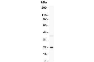 Western blot testing of Bid antbody and mouse brain lysate. (BID antibody  (C-Term))