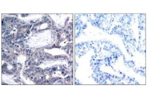 Image no. 3 for anti-Mitogen-Activated Protein Kinase Kinase 2 (MAP2K2) (pThr394) antibody (ABIN196623) (MEK2 antibody  (pThr394))