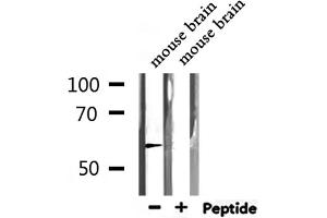 Western blot analysis of extracts from mouse brain, using TRIM21  Antibody. (TRIM21 antibody  (C-Term))