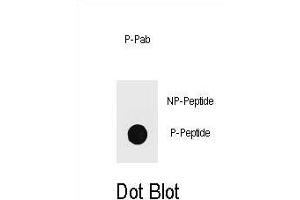 Dot blot analysis of TOPBP1 Antibody  Phospho-specific Pab (ABIN1539688 and ABIN2839838) on nitrocellulose membrane. (TOPBP1 antibody  (pSer1138))