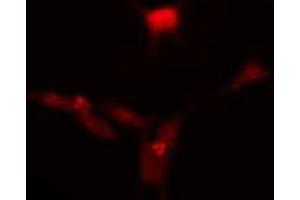 ABIN6275796 staining HeLa cells by IF/ICC. (CDC14A antibody  (Internal Region))