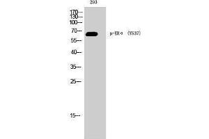 Western Blotting (WB) image for anti-Estrogen Receptor 1 (ESR1) (pTyr537) antibody (ABIN3173228) (Estrogen Receptor alpha antibody  (pTyr537))