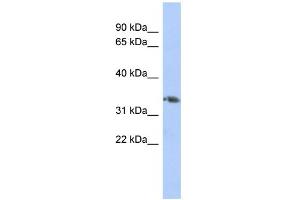 WB Suggested Anti-HOXD10 Antibody Titration:  0. (HOXD10 antibody  (Middle Region))