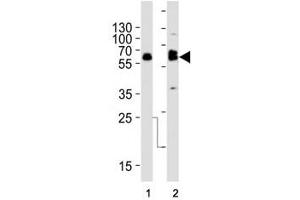 Western blot analysis of lysate from (1) SW480 and (2) U-87 MG cell line using TH antibody at 1:1000. (Tyrosine Hydroxylase antibody  (AA 486-514))