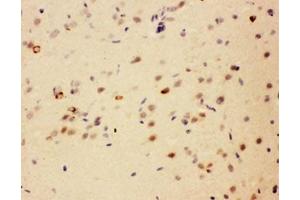 IHC testing of FFPE rat brain with SIP antibody. (CACYBP antibody  (Middle Region))