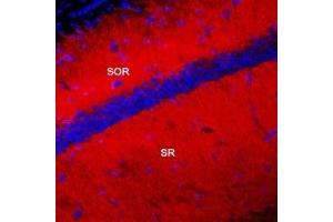 Expression of KV4. (KCND2 antibody  (C-Term, Intracellular))