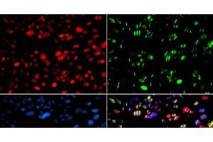 Immunofluorescence analysis of GFP-RNF168 transgenic U2OS cells using PNKP Polyclonal Antibody (PNKP antibody)