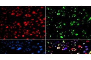 Immunofluorescence analysis of GFP-RNF168 transgenic U2OS cells using PNKP Polyclonal Antibody
