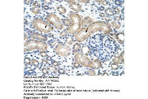 Rabbit Anti-RBM38 Antibody  Paraffin Embedded Tissue: Human Kidney Cellular Data: Epithelial cells of renal tubule Antibody Concentration: 4. (RBM38 antibody  (N-Term))