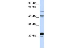 WB Suggested Anti-EVX1 Antibody Titration: 0. (EVX1 antibody  (N-Term))