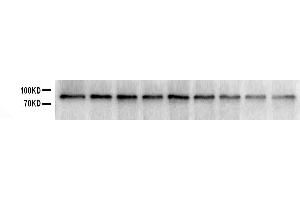 Western blot analysis of SOX5 using anti-SOX5 antibody . (SOX5 antibody  (C-Term))