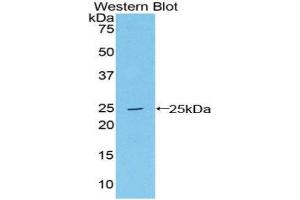 Western Blotting (WB) image for anti-Proteasome (Prosome, Macropain) Subunit, beta Type, 8 (Large Multifunctional Peptidase 7) (PSMB8) (AA 75-261) antibody (ABIN1859673) (PSMB8 antibody  (AA 75-261))